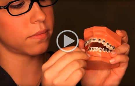 Brushing and Flossing video Kadan Orthodontics in Doylestown, Chalfont, Harleysville PA